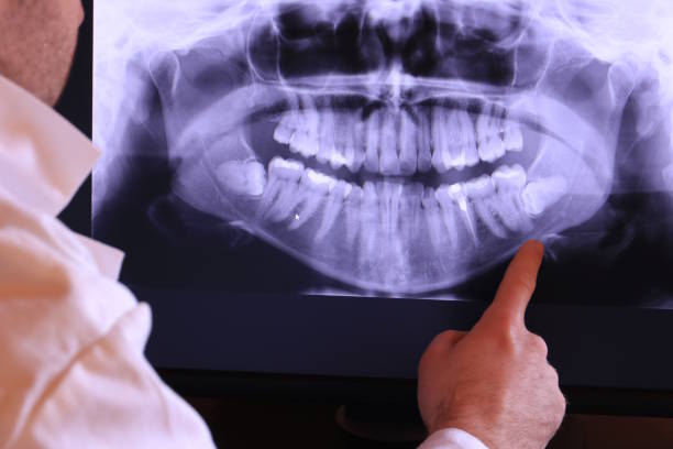Best Emergency Dental Services for Seniors in Hamtramck, MI
